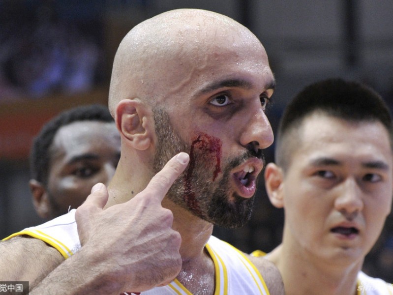 铁肘之下阿巴斯血染赛场 裁判争议判罚引主场震怒